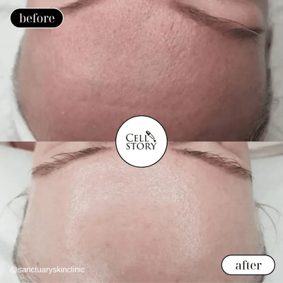 Resultado antes y después Cellstory 12